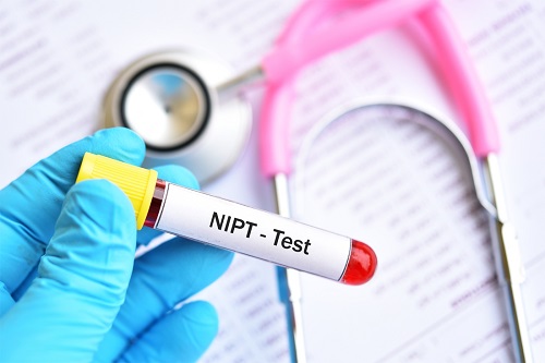 Xét nghiệm sàng lọc trước sinh không xâm lấn NIPT