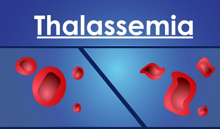 Hành trình ghép tế bào gốc chữa bệnh tan máu bẩm sinh (beta thalassemia)