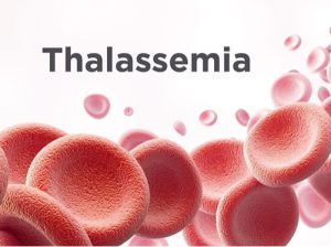 Thalassemia – bệnh thiếu máu tan máu bẩm sinh