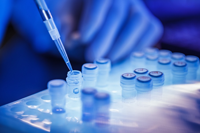 Xét nghiệm di truyền giúp bệnh nhân ung thư vú tránh được điều trị hóa chất không cần thiết