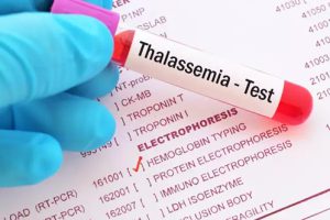 Xét nghiệm sàng lọc Thalassemia