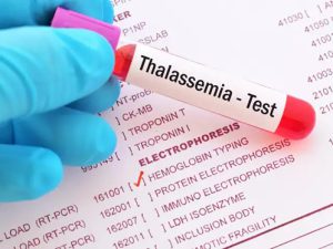 Xác định đột biến gen tan máu bẩm sinh Thalassemia