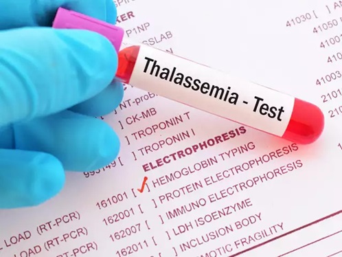 Xét nghiệm sàng lọc Thalassemia