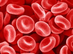 Thiếu máu tan máu do thiếu hụt enzyme G6PD