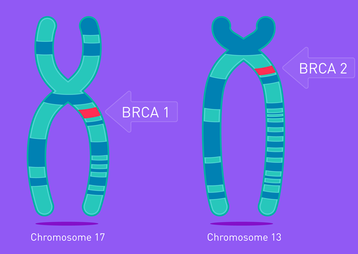 Xét nghiệm gen BRCA1/2 trong ung thư di truyền