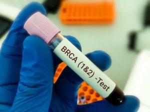 Sàng lọc nguy cơ mang đột biến gen BRCA1/2 gây tăng nguy cơ mắc ung thư vú, buồng trứng